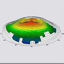 Компьютерная кератотопография глаза