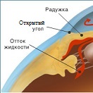 Открытоугольная глаукома 