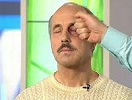 вдарили в око що робити?