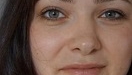 Одне око став менше іншого: причини, чому це може бути