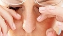 Как LASIK, так и ФРК приводят к формированию синдрома сухого глаза - Новости офтальмологии с сайта www.kompendium.com.ua