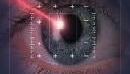Операция LASIK - лазерная коррекция зрения